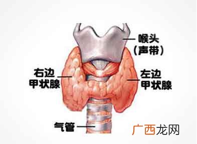什么叫甲状腺弥漫病变,甲状腺弥漫性实质病变意味着什么？