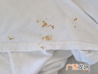 衣服血渍怎么去除,衣服有血怎样洗？