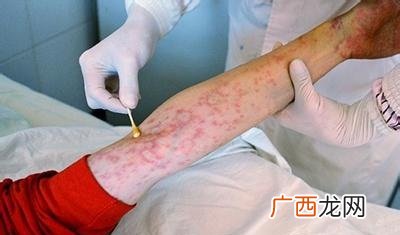 艾滋病感染多久才知道,艾滋病的潜伏期是多长时间？