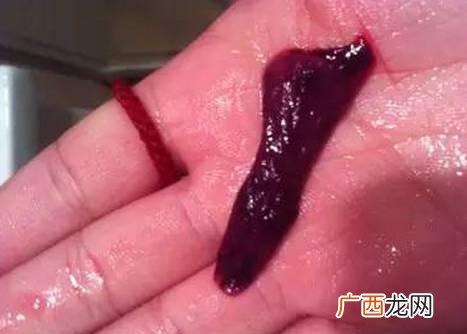 来姨妈有血块正常吗,大姨妈有血块正常吗？