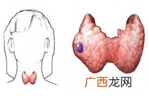 甲状腺在人体哪个部位,甲状腺的具体位置在哪里？
