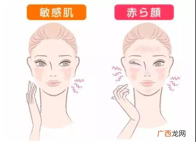 敏感肌是什么,什么是敏感肌和干皮？