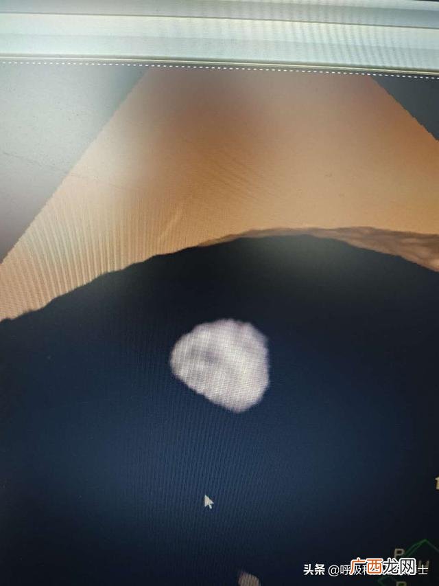 肺部节结怎么治疗,肺微小结节怎么治？