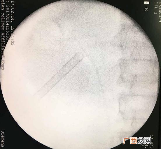 kub是什么检查,kub恒温饮水机开不了机？