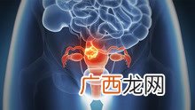 血液科是看什么病,内科系统哪几个科室比较重要？