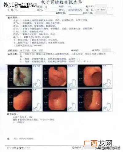 怎么治萎缩性胃炎,得了萎缩性胃炎该怎么治疗？