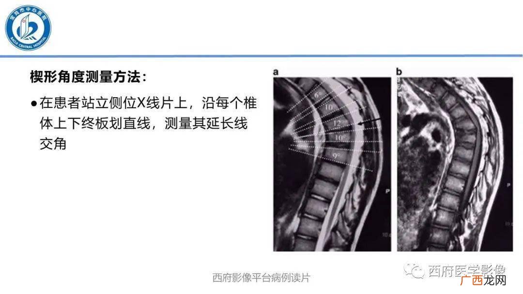 影像科是做什么的,医学影像技术专业毕业以后可以做什么,就要岗位有哪些?