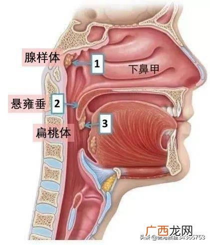 腺样体是什么,腺样体结构图？