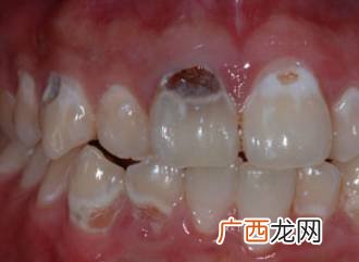 一口牙多少颗,一口牙齿三十颗是什么动物？