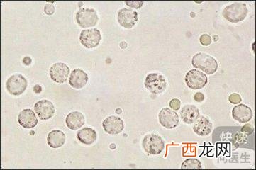 白细胞减少有什么危害,白细胞减少症严重么？