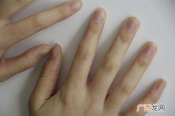 手指肿胀是什么原因,手指头肿了怎么回事？