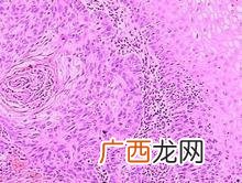 浸润是什么意思,浸润着温暖什么意思?