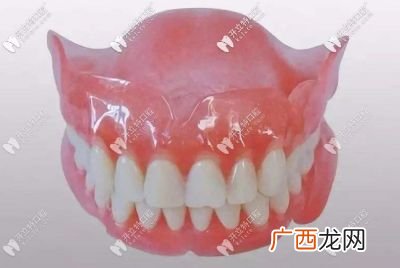 活动义齿哪种最舒服,活动假牙的优缺点是什么？