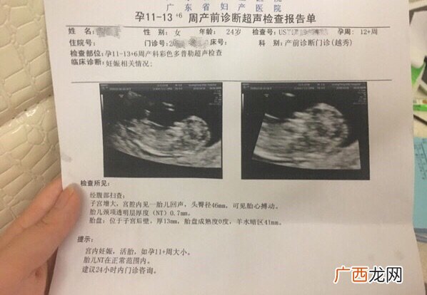 彩超和b超一样吗,彩超和b超有什么区别？