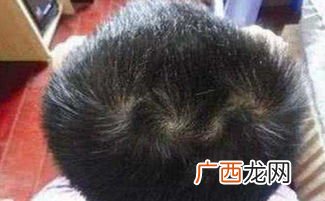 头上三个旋的男孩好吗,男孩头上两个穴象征着什么？
