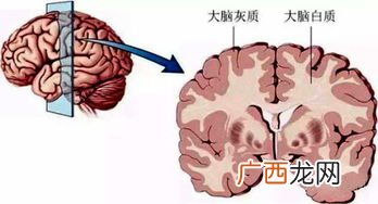 灰质和白质是什么东西,白质是什么？