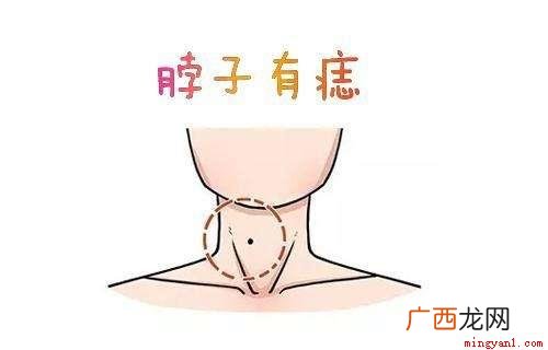 脖子上有痣的几种说法,这些是命相学上 脖子上有痣代表什么