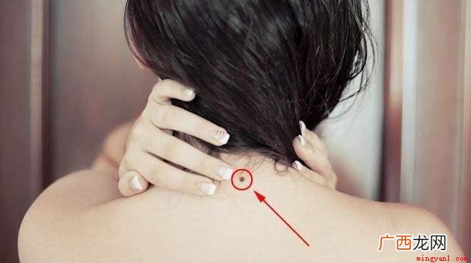 脖子上有痣的几种说法,这些是命相学上 脖子上有痣代表什么