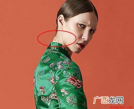 脖子上有痣的几种说法,这些是命相学上 脖子上有痣代表什么
