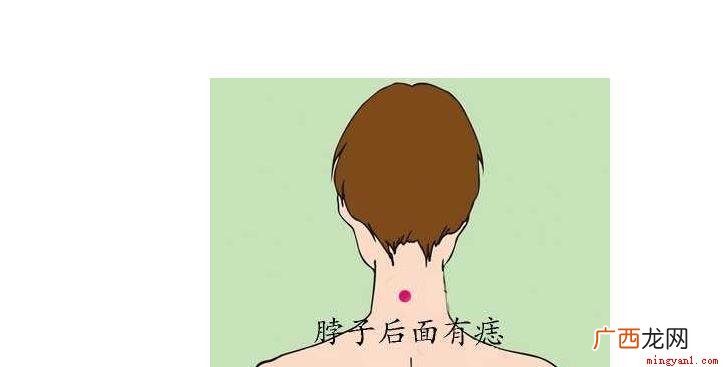 脖子上有痣的几种说法,这些是命相学上 脖子上有痣代表什么