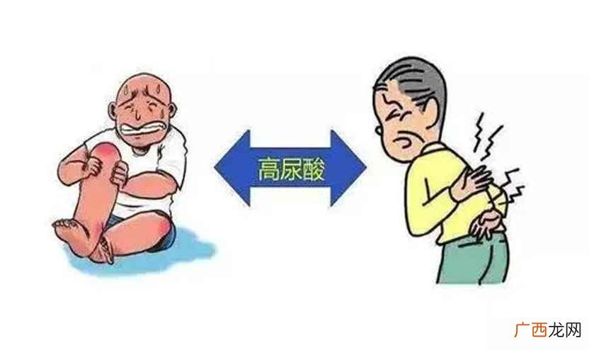 高尿酸食物有哪些