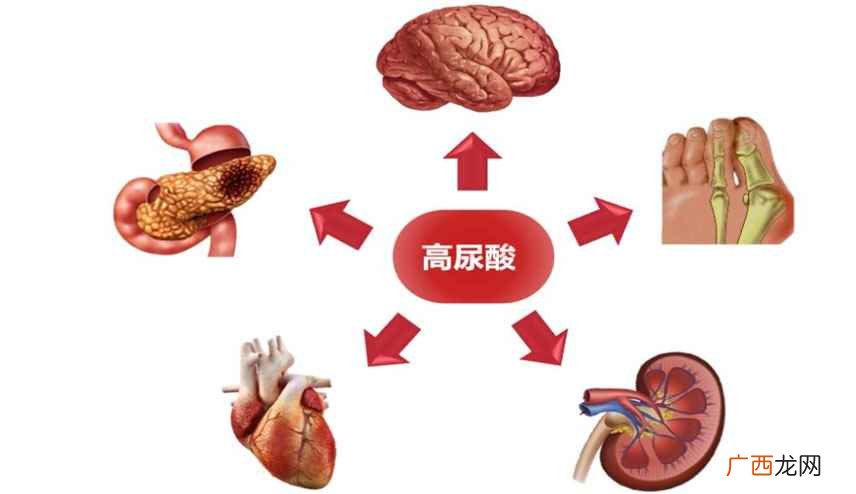 高尿酸食物有哪些