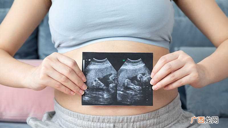 孕妇梦见死人是男的是什么意思