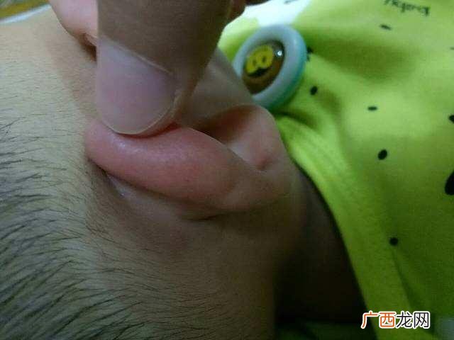为何新生宝宝耳朵上会有小洞 耳朵上有个小眼有福气