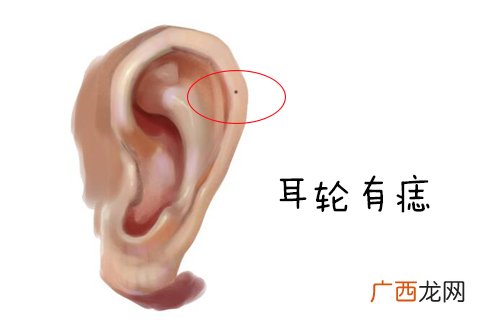 耳朵大富大贵痣的位置图解 耳朵前面有痣代表什么