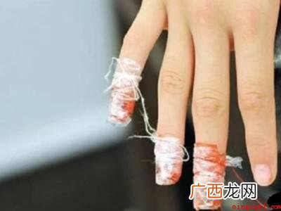 指甲花怎么染指甲步骤的具体操作步骤 指甲花怎么染指甲步骤
