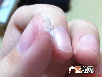 手上沾上520胶水怎么洗掉