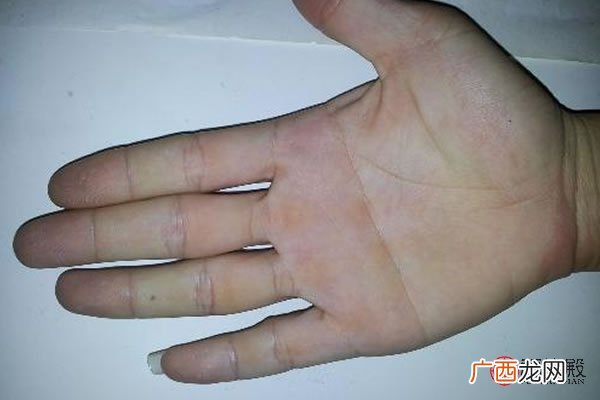 男人双手断掌命运详解 男人双手断掌代表什么意思