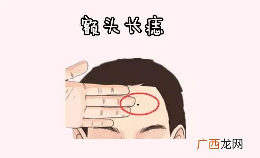 男人面部6处有痣痣相图解 男人脸上长痣面相图