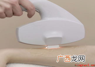 猕猴桃女孩怎么脱毛比较好 脱完毛要注意什么 猕猴桃女孩怎么脱毛比较好