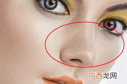 3处痣上长毛是富贵毛,不能动 痣上长毛代表有福气