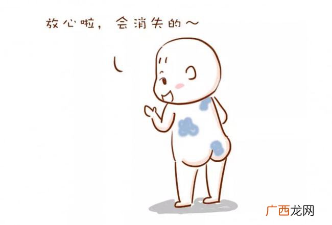 最有福气的10处胎记 背上有胎记代表什么
