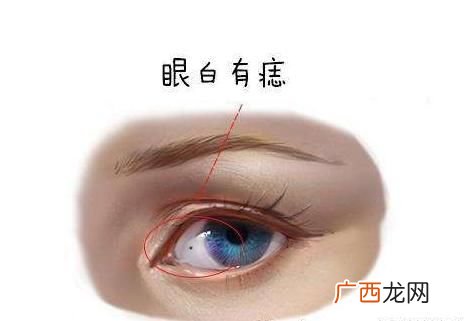 面部7处长痣婚姻不幸福 眼白有痣的女人好不好