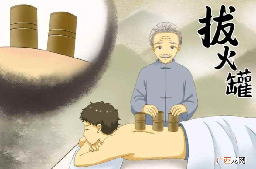 拔火罐过后4小时才能洗澡 拔火罐多久拔一次最好