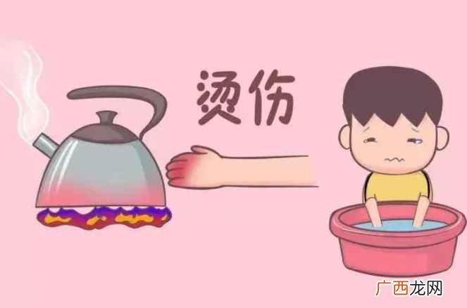 烫伤后起泡怎么办凉水冲洗 烫伤后涂牙膏有用吗