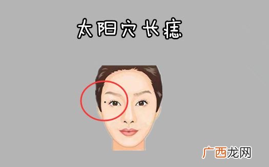 身上最有福气的吉痣讲解 身上哪些痣是好痣