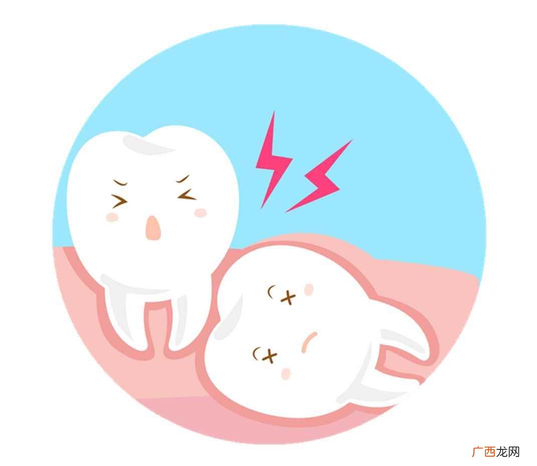 拔牙是口腔科最常用的治疗技术 智齿有必要拔吗