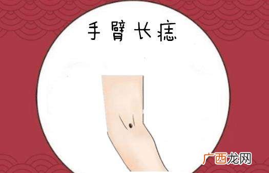 超详细 手臂上的痣的位置与命运图解