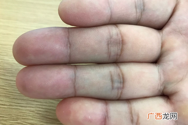 怎么看手上的斗和簸箕 手上的斗和簸箕的含义