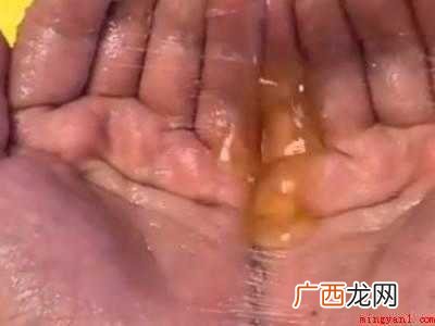 老鼠贴粘到手怎么洗掉的具体操作步骤 老鼠贴粘到手怎么洗掉