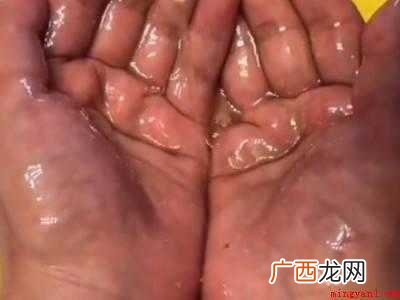 老鼠贴粘到手怎么洗掉的具体操作步骤 老鼠贴粘到手怎么洗掉