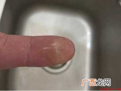 眼镜绿锈怎么清理的具体操作步骤 眼镜绿锈怎么清理