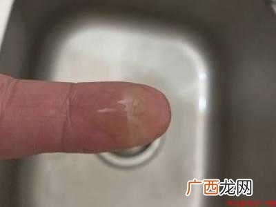 眼镜边框有绿色的东西怎么清除