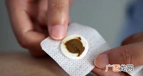 三伏天过了三伏贴还能贴吗 2022年三伏贴几时贴