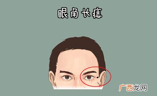 女人左眼周围痣相图解 左眼角有痣的女人好吗