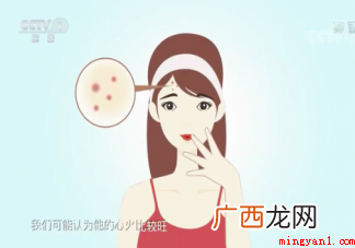 为什么成年后还会长痘痘